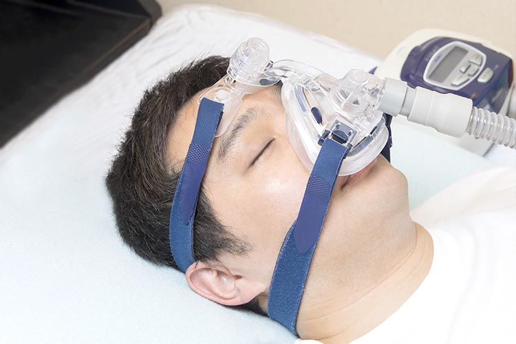 睡眠時無呼吸症候群画像