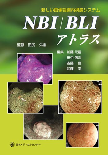 『新しい画像強調内視鏡システム　NBI/BLIアトラス』日本メディカルセンター　監修　田尻久雄大腸　Case 70(LST-NG偽陥凹型)
